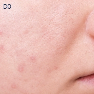 Biologique Recherche Serum Vivant - zaawansowane serum do skóry skłonnej do niedoskonałości